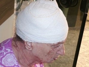 Mulher de 67 anos vai parar no hospital aps ser agredida